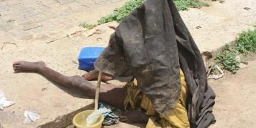 Nord-Kivu : au moins 25 nouveaux cas des maladies mentales notifiés chaque mois à Butembo