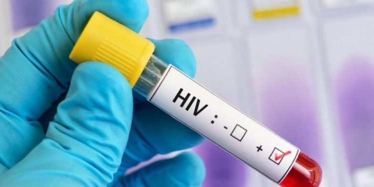 Nord-Kivu : 1.168 cas positifs du VIH/SIDA notifiés en l’espace de 10 mois en ville de Butembo