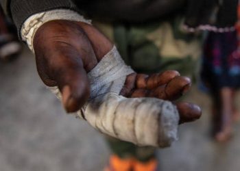 Rutshuru : un jeune présumé collaborateur d’un chef milicien blessé par balle par un élément de la Police près de Kibirizi