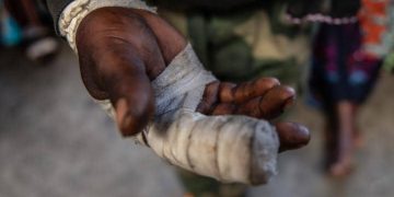 Rutshuru : un jeune présumé collaborateur d’un chef milicien blessé par balle par un élément de la Police près de Kibirizi