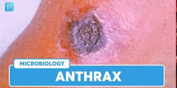 Lubero : la zone de santé intensifie la sensibilisation sur les signes et symptômes de l’anthrax après la guérison de cas suspects