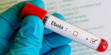 Ebola au Nord-Kivu : point sur la situation épidémiologique au 27 mai